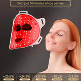 LumaDerm™ Máscara Terapia Luz